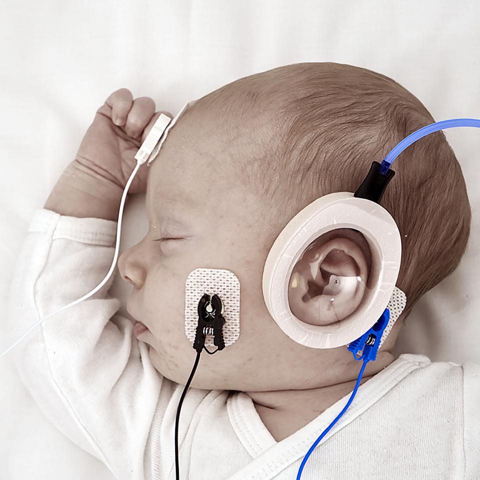 Equipo de potenciales evocados auditivos Screening