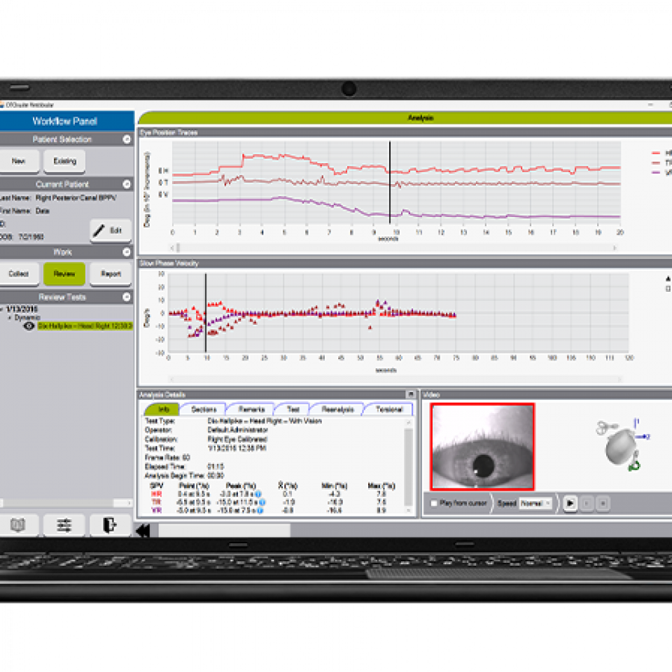 Natus ICS IMPULSE Monocular VNG con ordenador portátil