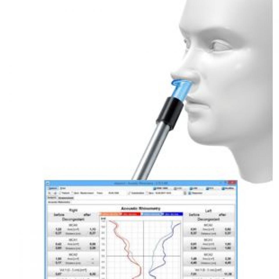 Rinometría Acústica