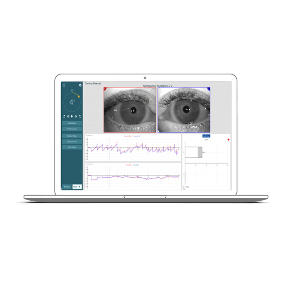 VideoNistagmografia VNG VISUALEYES 525 S USB con PC Desktop